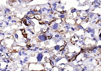 Fibrinogen alpha chain Rabbit Polyclonal Antibody