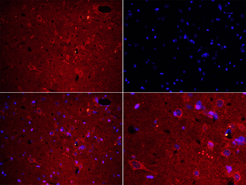 Fibrinogen alpha chain Rabbit Polyclonal Antibody