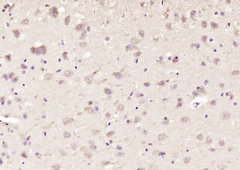 FOXO1 + FOXO3 + FOXO4 Rabbit Polyclonal Antibody