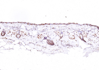 ATF4 Rabbit Polyclonal Antibody