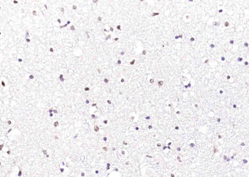 ATF4 Rabbit Polyclonal Antibody
