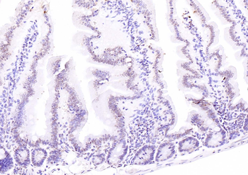 ATF4 Rabbit Polyclonal Antibody