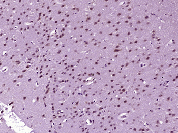 DFFB Rabbit Polyclonal Antibody