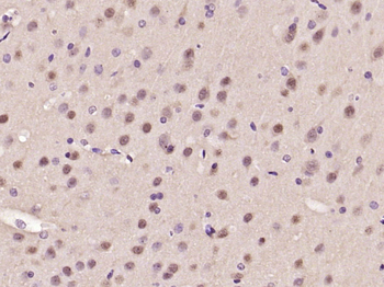 ATF6 Rabbit Polyclonal Antibody