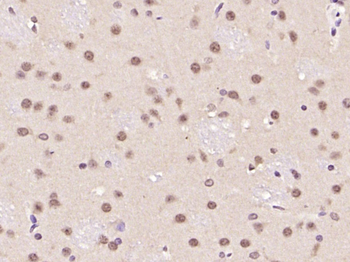 ATF6 Rabbit Polyclonal Antibody