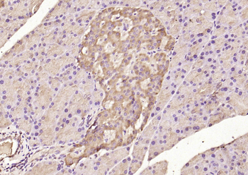 ATF6 Rabbit Polyclonal Antibody