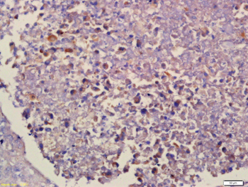 SERTAD2 Rabbit Polyclonal Antibody