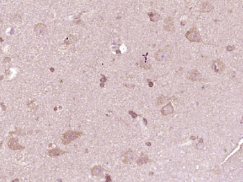 ATP7A Rabbit Polyclonal Antibody