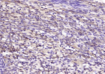 CAPD2 Rabbit Polyclonal Antibody