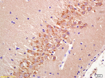 FMN2 Rabbit Polyclonal Antibody