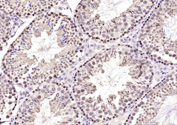 NEK7 Rabbit Polyclonal Antibody