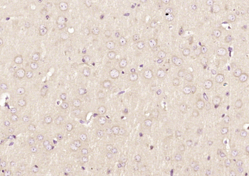 KNTC1 Rabbit Polyclonal Antibody