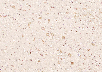 RINT1 Rabbit Polyclonal Antibody