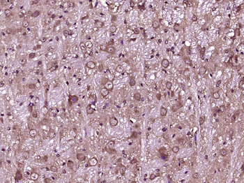 CEND1 Rabbit Polyclonal Antibody