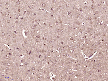 CEND1 Rabbit Polyclonal Antibody