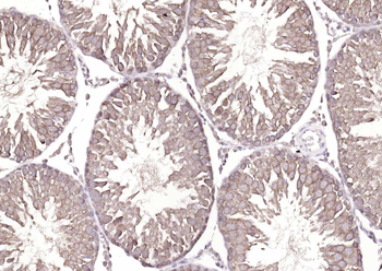 ATP7B Rabbit Polyclonal Antibody