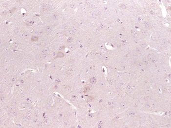 ATP7B Rabbit Polyclonal Antibody