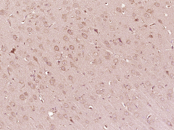 ATP7B Rabbit Polyclonal Antibody