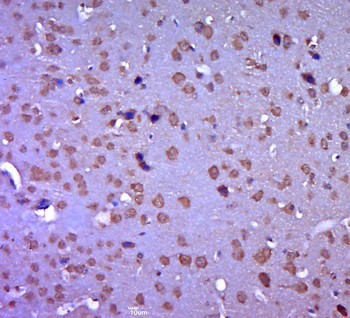 Vesicle docking protein p115 Rabbit Polyclonal Antibody