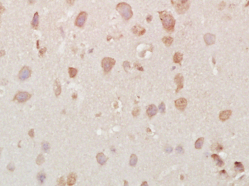 Vesicle docking protein p115 Rabbit Polyclonal Antibody
