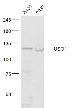 Vesicle docking protein p115 Rabbit Polyclonal Antibody