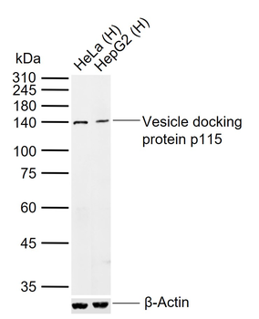 Vesicle docking protein p115 Rabbit Polyclonal Antibody