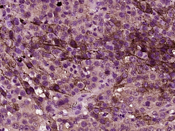 FAP Rabbit Polyclonal Antibody