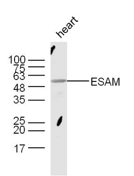 ESAM Rabbit Polyclonal Antibody