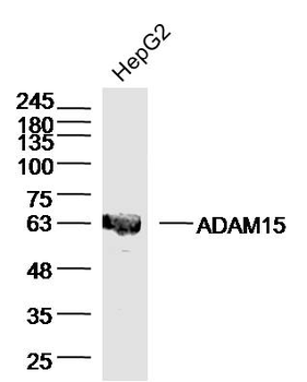 ADAM15 Rabbit Polyclonal Antibody