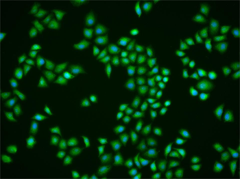 CIP2A/p90 Autoantigen Rabbit Polyclonal Antibody