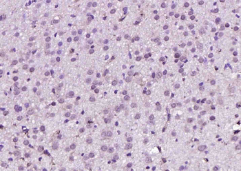 NARG2 Rabbit Polyclonal Antibody