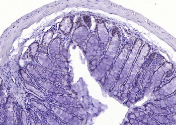 MYB Rabbit Polyclonal Antibody