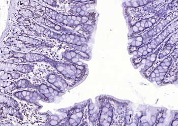 MYB Rabbit Polyclonal Antibody