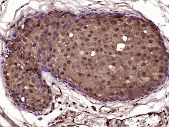 GADD45GIP1 Rabbit Polyclonal Antibody