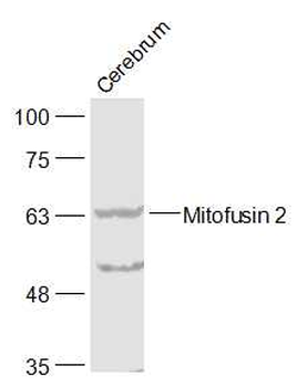 Mitofusin 2 Rabbit Polyclonal Antibody