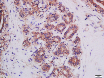 Mitofusin 2 Rabbit Polyclonal Antibody