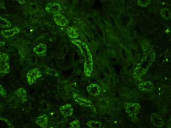Mitofusin 2 Rabbit Polyclonal Antibody