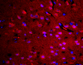 RASAL1 Rabbit Polyclonal Antibody