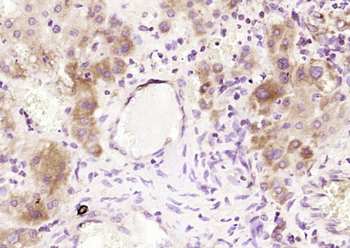 Alpha 2 antiplasmin Rabbit Polyclonal Antibody