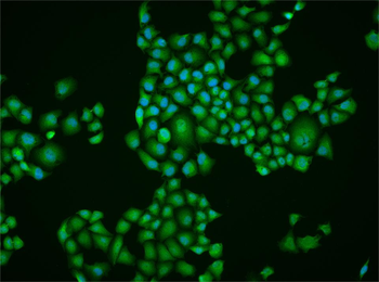 RAR gamma Rabbit Polyclonal Antibody