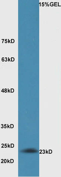 Bak Rabbit Polyclonal Antibody