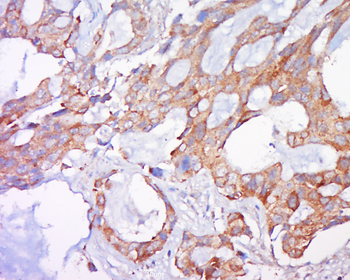 Bak Rabbit Polyclonal Antibody