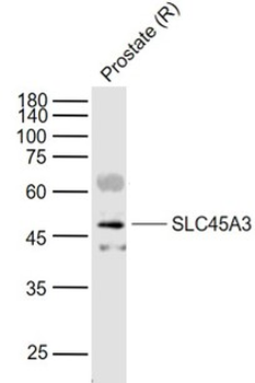 SLC45A3 Rabbit Polyclonal Antibody