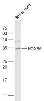 HOXB5 Rabbit Polyclonal Antibody