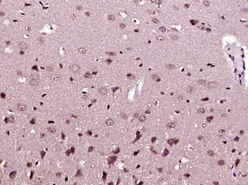 SCN8A/Nav1.6 Rabbit Polyclonal Antibody