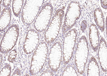 ITIH1 Rabbit Polyclonal Antibody