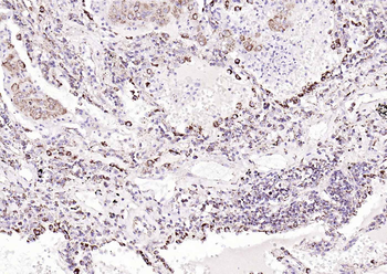 ITIH1 Rabbit Polyclonal Antibody
