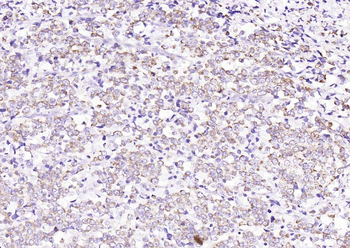 ITIH1 Rabbit Polyclonal Antibody