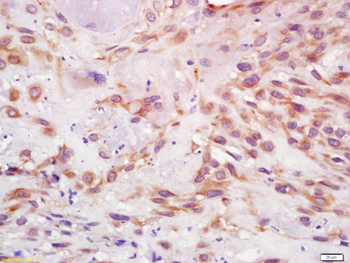 IGF I Rabbit Polyclonal Antibody