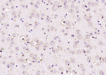 Coronin 3 Rabbit Polyclonal Antibody